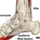 Prehallux Syndrome(﻿accessory navicula bone) 이미지