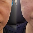 베러스킨의원 이미지