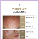 고당한의원 네이버블로그