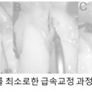 솔치과기공소 이미지