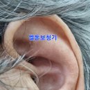 이든보청기 | 천안보청기 벨톤보청기 이든 구매후기 가격 위치