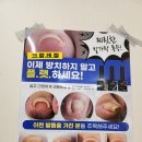 알미네일 이미지