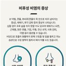 S0205 이미지