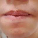 김태형피부과의원 | 대구광역시 달서구 장기동 대상포진 전문병원 추천 | 무료접종 | 예방접종