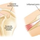 하단튼튼정형외과의원 이미지