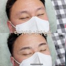 엠보디아 네이버블로그
