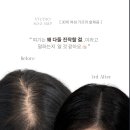 김포두피문신 구래동에서 찾는다면? 자연스러운 결과를 만드는 기준