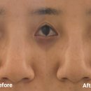 용연동길 | 천안 탕정 피부샵 추천 ㅣ '예움 에스테틱' 10초 미인관리 후기