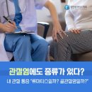 내 관절 통증, 류마티스일까? 골관절염일까? 관절염에도 종류가 있다? 류마티스 관절염과 골관절염 차이점 이미지