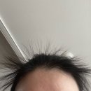 나만봄 헤어 | 출산 후 탈모... 봄비유 단백질 헤어 트리트먼트로 관리 시작 후기