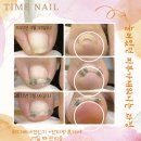 타임네일 페디베네 이미지