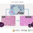 분화암(Differentiated Cancer)과 미분화암(Undifferentiated Cancer)의 차이점 이미지
