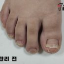 레푸스 사상점 이미지