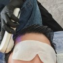 글로벌튼튼병원 | 동탄 두피관리 탈모&두피밥 동탄점 후기