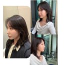 리뉴피부과의원 | 압구정피부과 온다리프팅 (8만줄) 후기