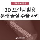 동아엑스레이(X-RAY)메디컬 | 구조 강아지 상완골 복합 골절 수술 후 회복 사례 | 3D 프린팅 활용 - 울산 동물병원 에스동물메디컬센터