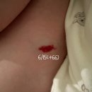 이석종피부과의원 네이버블로그
