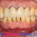 스마일교정치과기공소 이미지