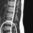 무척바른한의원 이미지