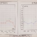 대전으뜸보청기 이미지