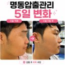 온한의원 - 수원시 영통구 봉영로1770번길 21 | 명동압출관리 여드름한의원 꼼꼼한 압출 받고 온 후기