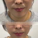 유제이 | 김해 두피관리 유제이뷰티 김해점 헤어스파 후기