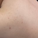 UR(파주시)-[와석순환로515번길]-상-1 | 파주 어썸뷰티랩 : 왜 소개로만 오는 집인지 알겠더라고요! (남편 등드름 약초필 &amp; 눈썹제거 후기)