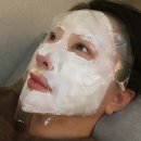 멍베스트 | 논현피부과 / 줄기세포피부주사 후기 30cc / 붓기 멍