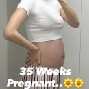 정선군보건소북평면지소 | [임신35주]배크기.몸무게.증상.운동.막달검사.출장산전마사지.파크로쉬태교여행