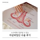 The나은약국 | 자궁외임신 나팔관절개 수술 후기 (+유산바우처 신청)