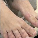 매료 | 부산 서면 부전동 발톱무좀 케어 매료네일in뷰티 후기