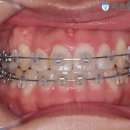 모치과기공소 이미지