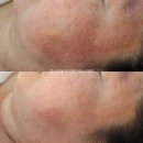 [군산피부관리] 얼굴만 관리했는데 전신이 시원해졌다는 미네랄아쿠아스파 후기