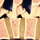 중계넘버원정형외과의원 이미지