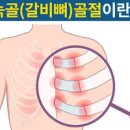 갈비뼈 실금 증상 4가지, 추후 관리 팁까지 정리해요 이미지