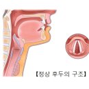 성대와 후두 결절[Nodules of vocal cord and larynx]귀코목질환 이미지
