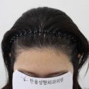 더예쁜성형외과의원 이미지