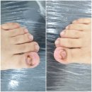 레푸스 앤 두두네일 이미지