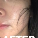 기가모터스 | 일산 킨텍스역 지서원에스테틱에서 피부 물방울 리프팅 관리 받은 후기