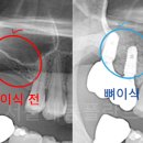 서울새봄플란트치과의원 이미지
