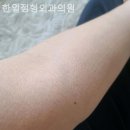 한일외과의원 네이버블로그