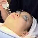 CU 첨단희망점 | 강남역레이저토닝 기미 치료 돈 날리고 싶지 않은 분들은 보세요