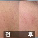 유니드케어 이미지