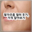 더붐 | 팔자주름 필러 후기, 가격 알아보기