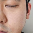 에슬 PLLA 에이지리셋링클크림 플러스 후기 집에서 하는 팔자주름관리 팔자필러크림 찾는다면?