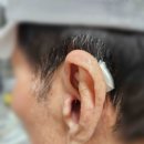 성북푸른보청기 | 강북구보청기 성북푸른보청기 만족후기