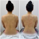 송파체형관리 우아선 승모근관리로 라인 정리했어요