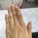 로키키네일