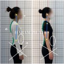 하람어린이집 | [부평 삼산동/굴포천역 필라테스] 체형교정 및 바디프로필후기