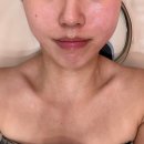 노진희피부연구소 | 울산 리프팅 노진희 피부연구소 써마튠 내돈내산 후기